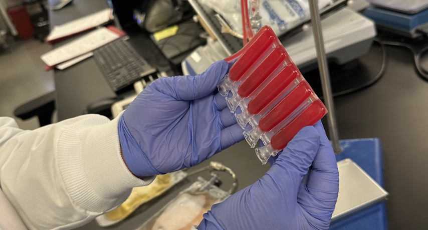 Key Health Indicators Affecting Autoimmune Stem Cell Therapy Success Rates